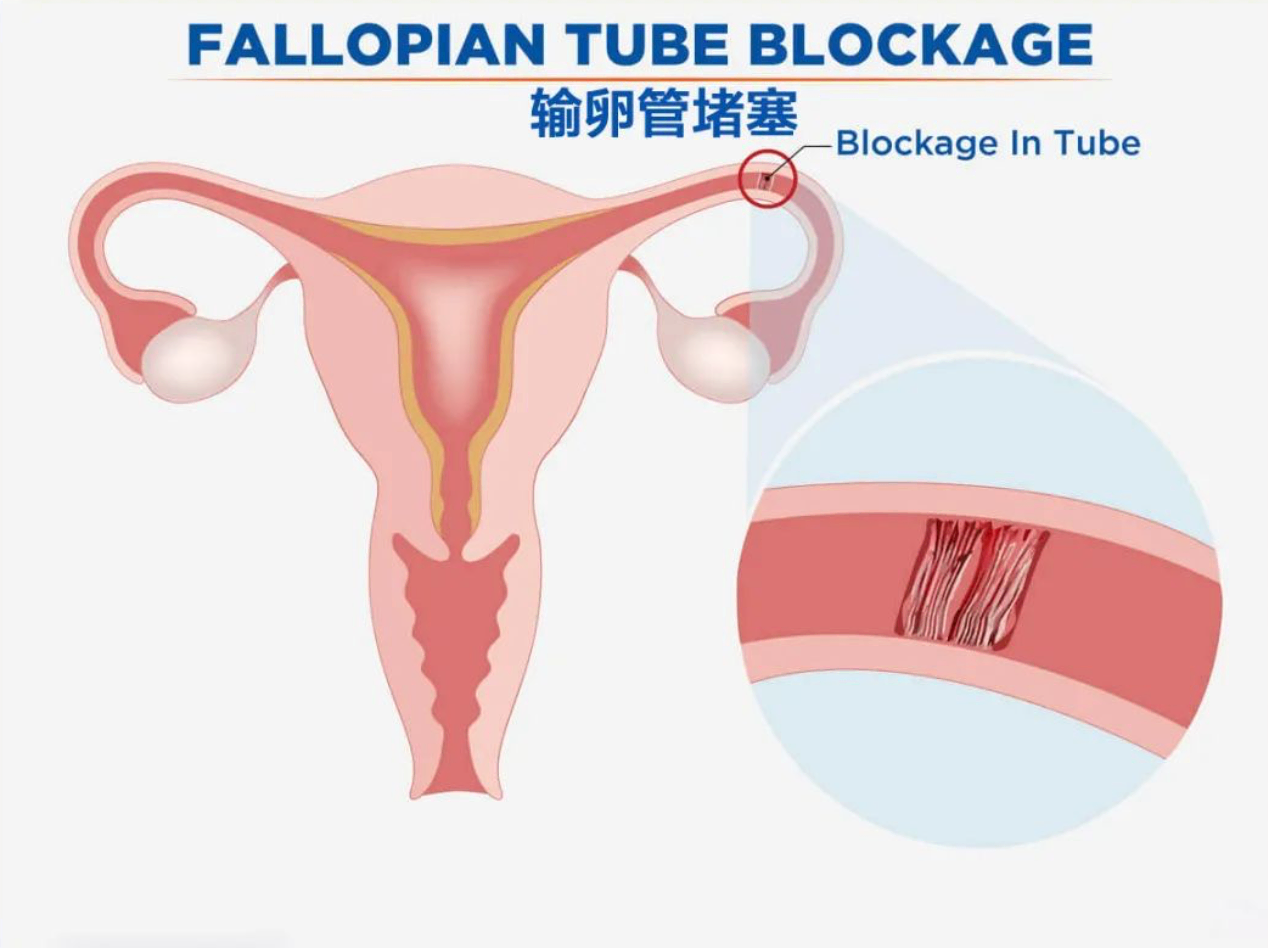 1604499209944203.png 截屏2020-11-04 下午10.12.25.png