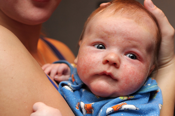 泰国试管婴儿图片